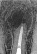 レントゲン画像