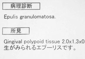 病理組織診断